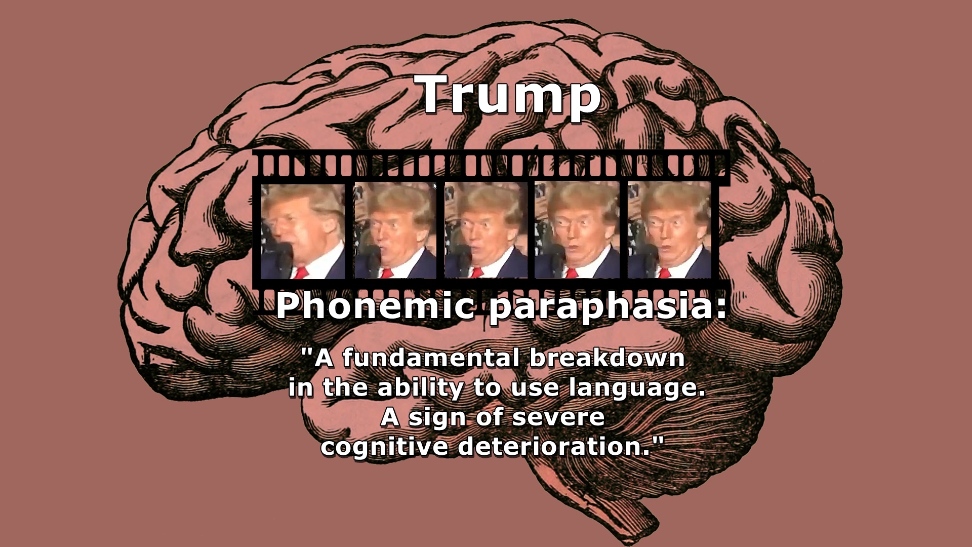 Trump, phonemic paraphasia, language breakdown, cognitive deterioration